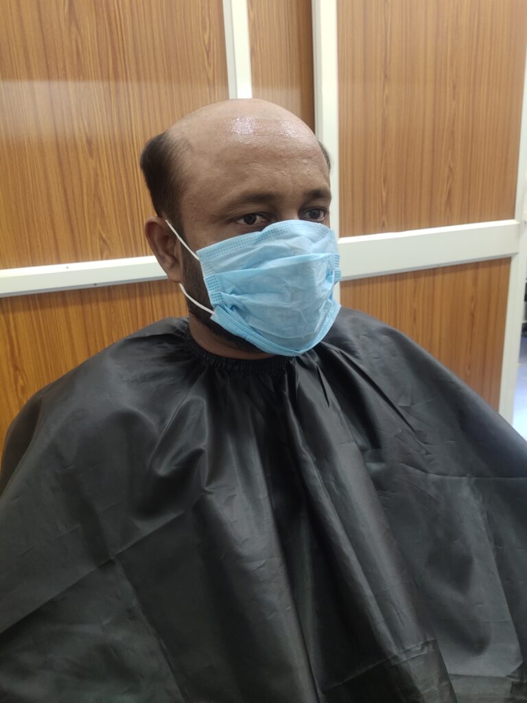hair patch in bhubaneswar